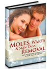 Moles, Warts and Skin Tags Removal PDF